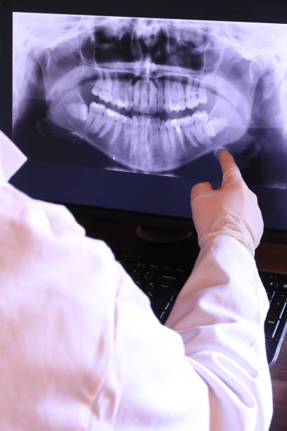 Best Knocked-Out Tooth (Avulsed Tooth) Treatment in Ithaca, MI